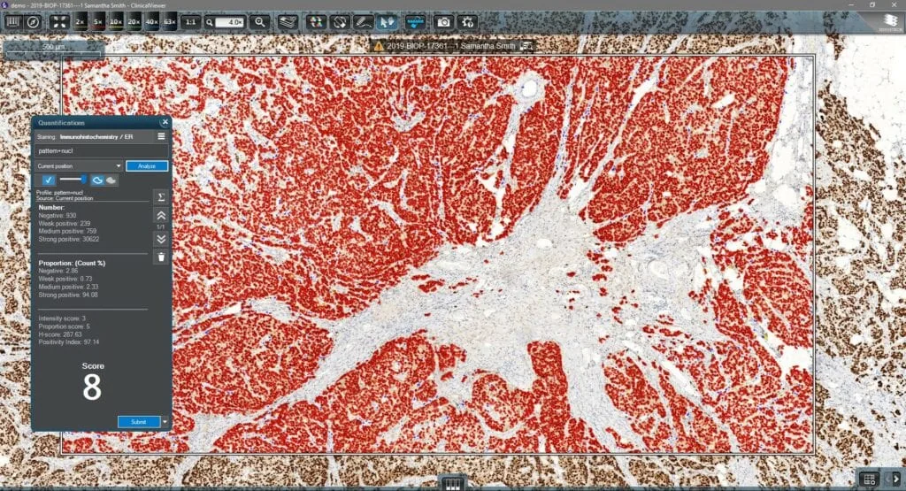Virtual 3D pathology slide scanner, associated with inventor Béla Molnár