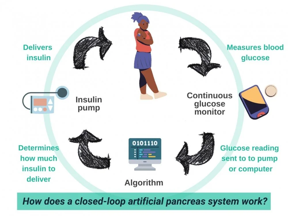 Closed-loop artificial-pancreas systems, associated with inventor Boris P.Kovatchev