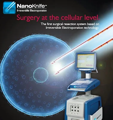 NanoKnife irreversible-electroporation tumor-ablation system, associated with inventor Boris Rubinsky