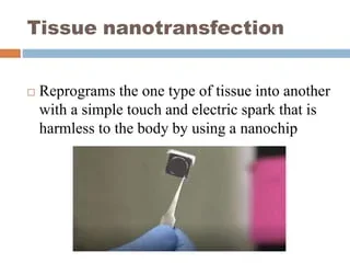 Electroceutical and nanotransfection devices, associated with inventor Chandan K. Sen