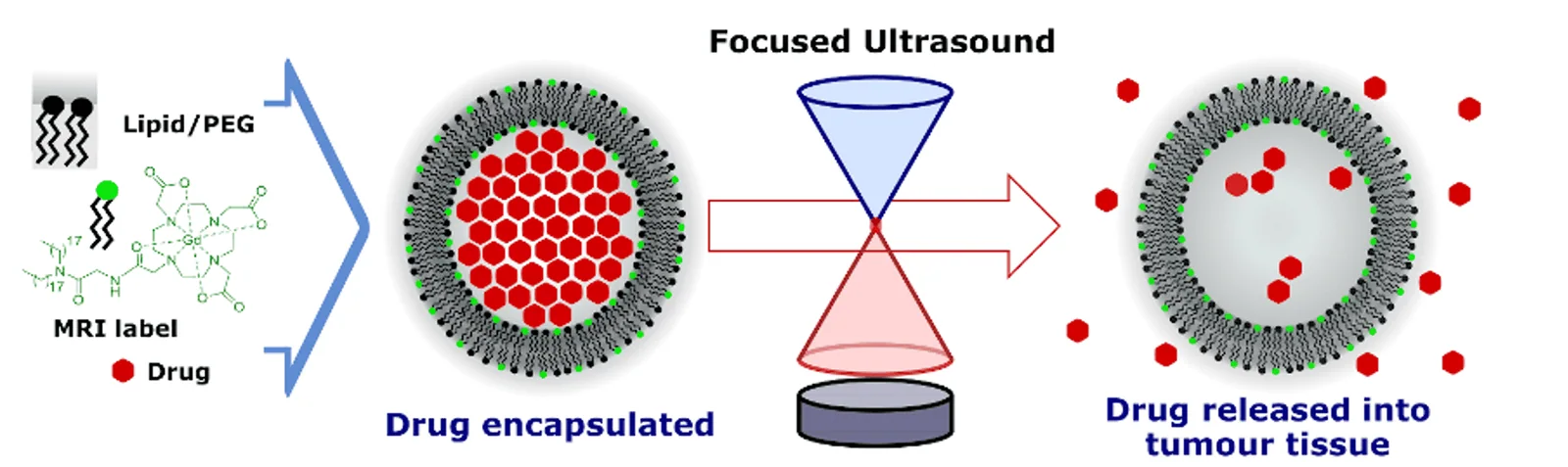 focused-ultrasound imaging and therapeutic-delivery systems, associated with inventor Elisa Konofagou