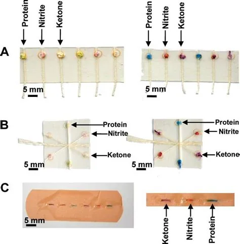 Paper-based microfluidic diagnostic device, associated with inventor George M. Whitesides