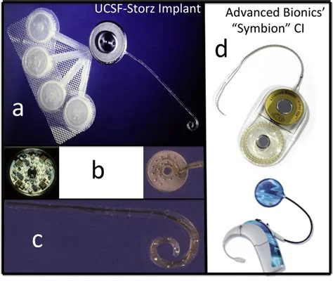 Multichannel cochlear implant, associated with inventor Graeme Clark