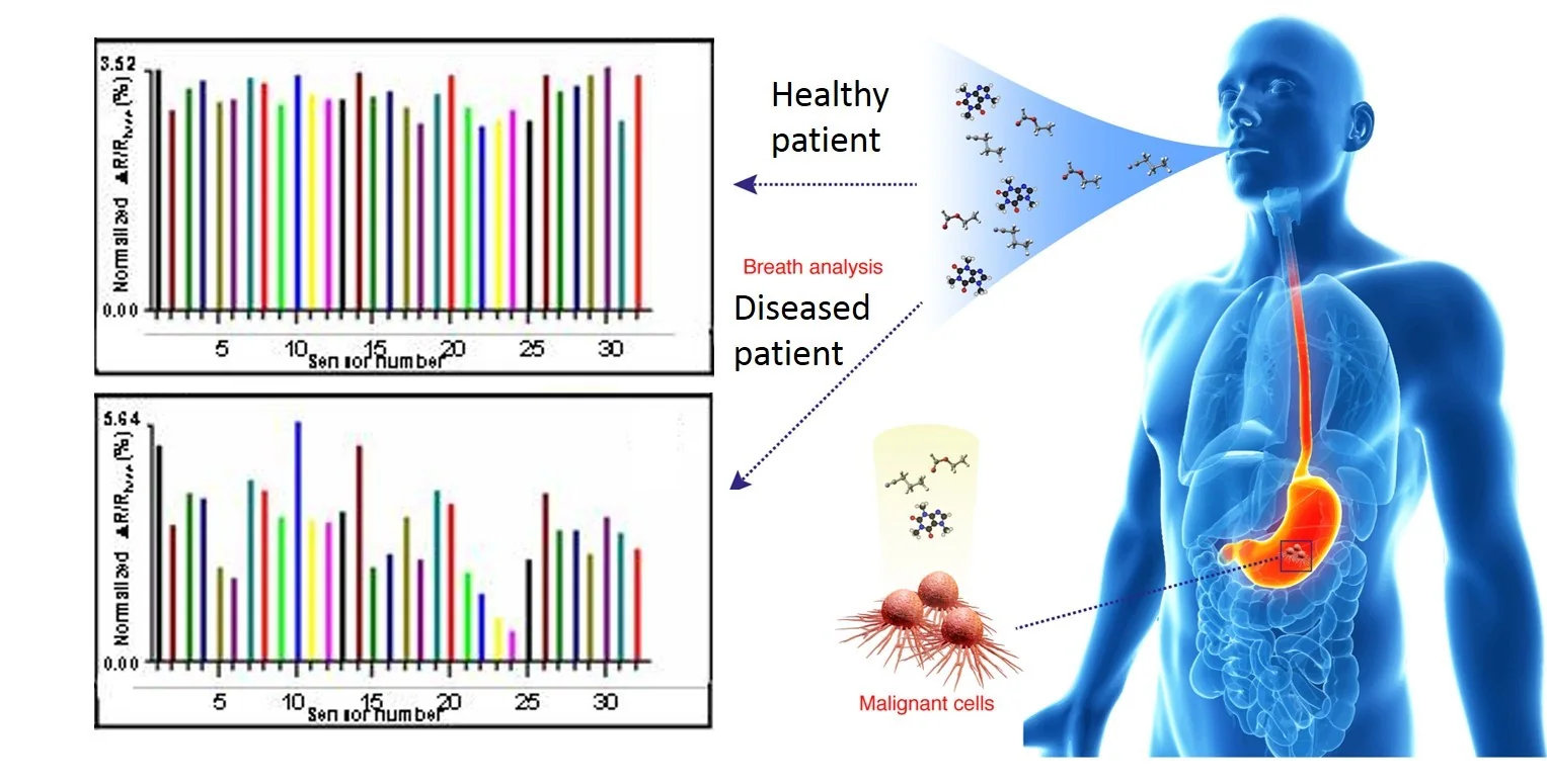 NA-NOSE volatile-biomarker nanoarray diagnostic sensors, associated with inventor Hossam Haick