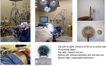 Implantable ventricular-assist devices, associated with inventor James Antaki