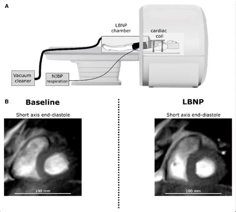 FLASH real-time magnetic-resonance-imaging method, associated with inventor Jens Frahm