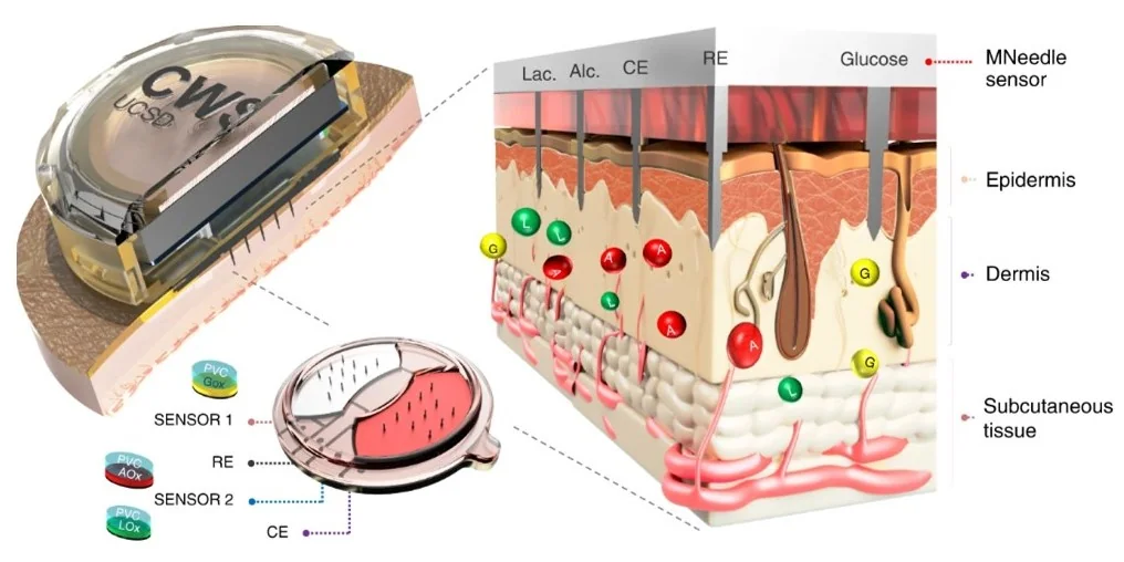 Wearable sweat biosensors and microneedle diagnostic devices, associated with inventor Joseph Wang