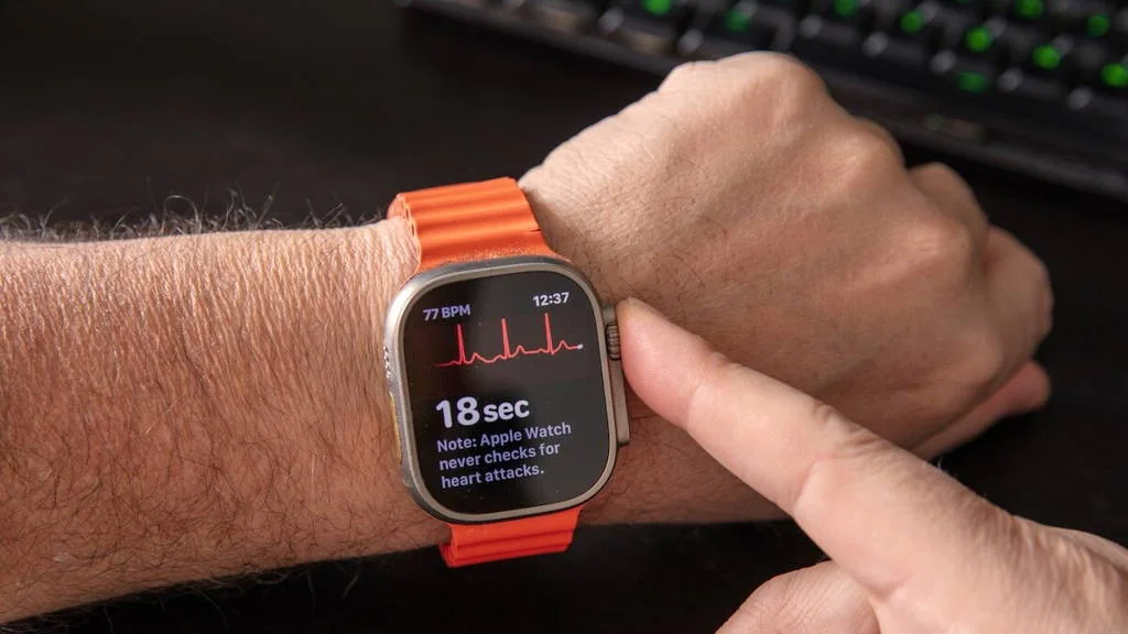 Smartphone, smartwatch, and Holter-monitor atrial-fibrillation detection systems, associated with inventor Ki H. Chon
