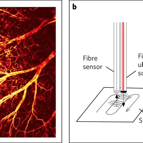 optical microresonator sensors and NeedleVue LC1 ultrasound system, associated with inventor Lan Yang