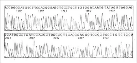 Automated fluorescent DNA sequencer, associated with inventor Leroy Hood