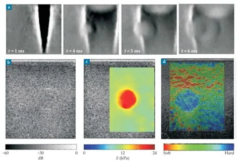 Shear-wave ultrasound imaging system, associated with inventor Mathias Fink