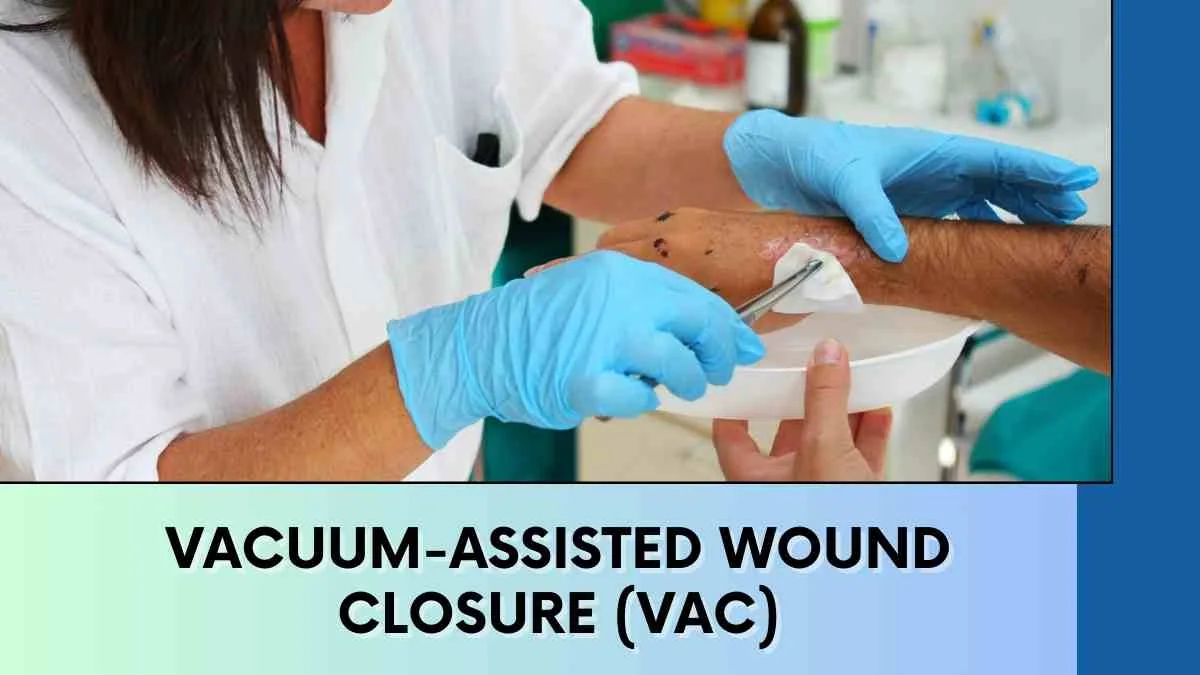 Vacuum Assisted Closure wound-treatment device, associated with inventor Michael Morykwas