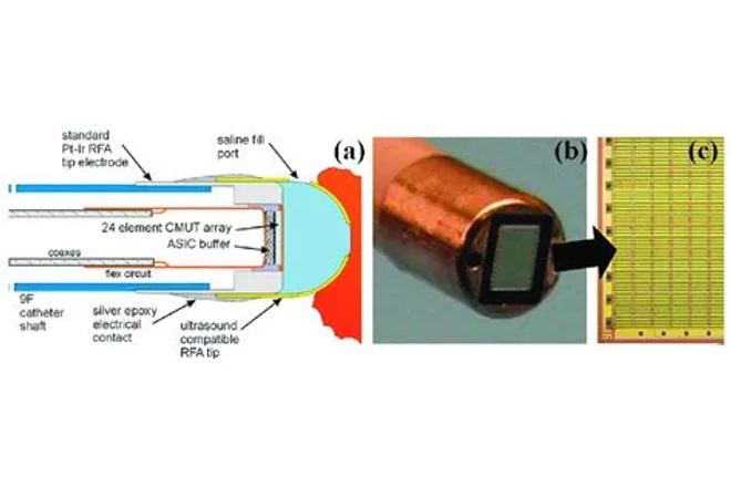 CMUT medical ultrasound transducers commercialized in imaging products, associated with inventor Rasim Guldiken