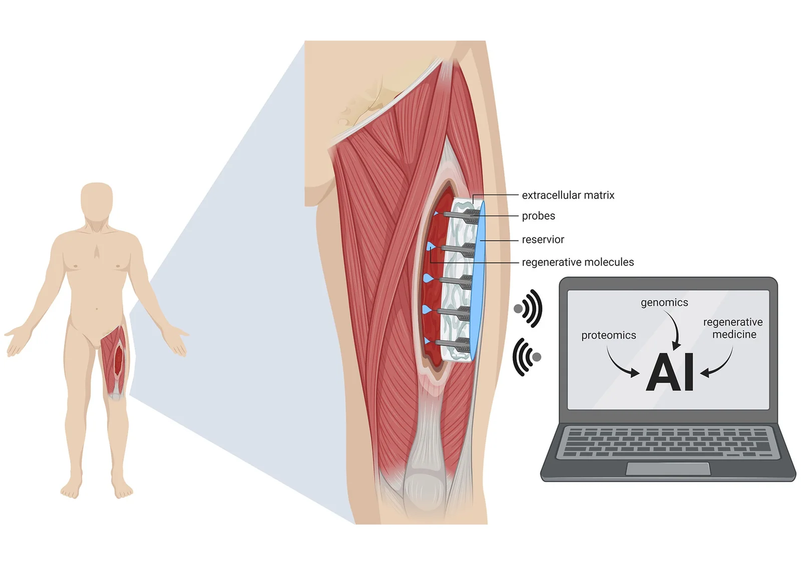 Extracellular-matrix regenerative-medicine devices, associated with inventor Stephen F. Badylak