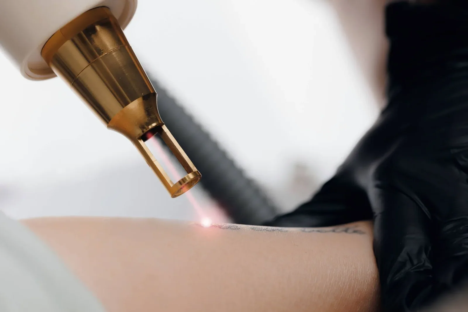 Compact ultra-intense lasers for tattoo removal and flapless LASIK, associated with inventor Szymon Suckewer